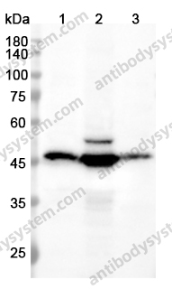 Anti-CYP17A1 Polyclonal Antibody