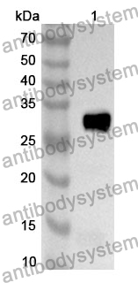 Anti-CD61/ITGB3 Polyclonal Antibody