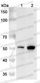 Anti-Human CYP11A1 Polyclonal Antibody