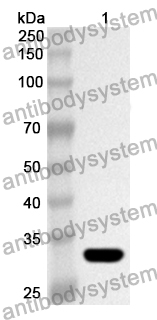 Anti-Human SLC25A5 Polyclonal Antibody