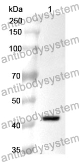 Anti-SERPINA5 Polyclonal Antibody