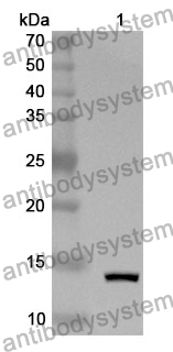 Anti-SERPING1 Polyclonal Antibody