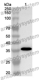 Anti-CFI Polyclonal Antibody