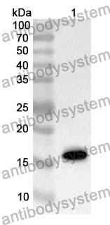 Anti-LGALS2 Polyclonal Antibody