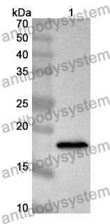 Anti-PCCA Polyclonal Antibody