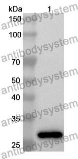 Anti-PCCB Polyclonal Antibody