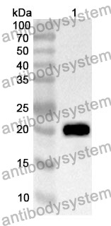 Anti-FGF1 Polyclonal Antibody