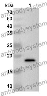 Anti-FABP3 Polyclonal Antibody