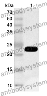 Anti-CLEC3B Polyclonal Antibody