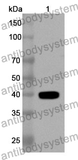 Anti-Human PRKCB Polyclonal Antibody