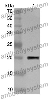 Anti-KRT18 Polyclonal Antibody