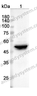 Anti-KRT8/CK-8 Polyclonal Antibody