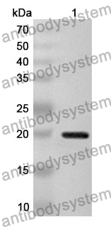 Anti-CSN2 Polyclonal Antibody