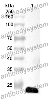 Anti-CD220/INSR Polyclonal Antibody