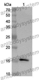 Anti-BCHE Polyclonal Antibody