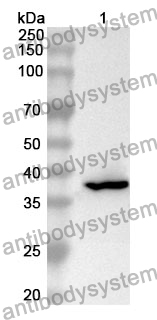 Anti-CCK Polyclonal Antibody