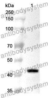 Anti-RB1 Polyclonal Antibody