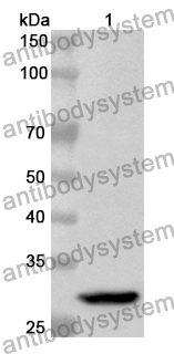 Anti-Human PGR Polyclonal Antibody