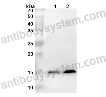 Anti-S100A9 Polyclonal Antibody