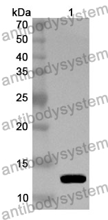 Anti-S100A6 Polyclonal Antibody