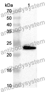 Anti-Human EIF4E Polyclonal Antibody