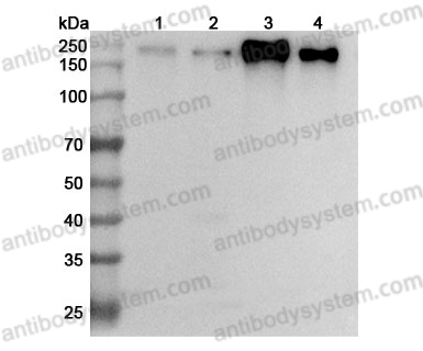 Anti-CD66e/CEA/CEACAM5 Polyclonal Antibody