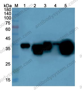 Anti-CKM Polyclonal Antibody