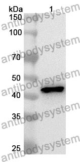 Anti-Human CK-MB Polyclonal Antibody