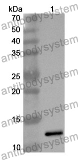 Anti-ENO1 Polyclonal Antibody