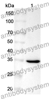 Anti-CD23/FCER2 Polyclonal Antibody