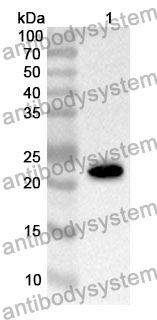 Anti-PYGL Polyclonal Antibody