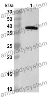 Anti-Human POLB Polyclonal Antibody