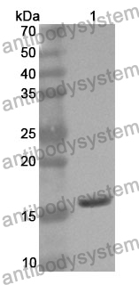 Anti-NPM1 Polyclonal Antibody