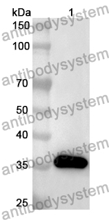 Anti-TPM3 Polyclonal Antibody