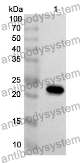 Anti-CD51/ITGAV Polyclonal Antibody