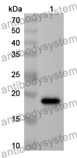 Anti-CRH Polyclonal Antibody