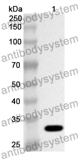 Anti-LPL Polyclonal Antibody