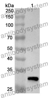 Anti-HEXA Polyclonal Antibody