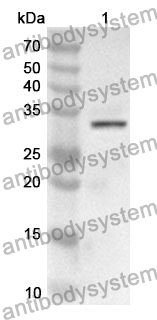 Anti-KLK1 Polyclonal Antibody