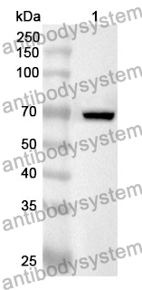 Anti-LIPF Polyclonal Antibody