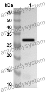 Anti-TH Polyclonal Antibody