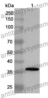 Anti-Human DBI Polyclonal Antibody