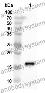 Anti-FABP1 Polyclonal Antibody