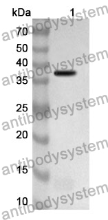 Anti-LDHB Polyclonal Antibody