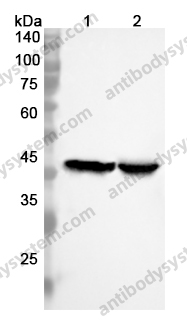 Anti-LDHB Polyclonal Antibody