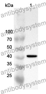 Anti-NEFL Polyclonal Antibody