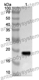 Anti-GPX1 Polyclonal Antibody