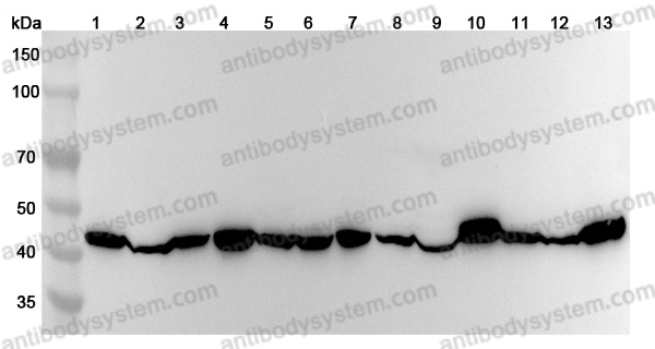 Anti-Human PGK2 Polyclonal Antibody