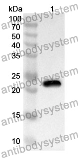 Anti-PROS1 Polyclonal Antibody