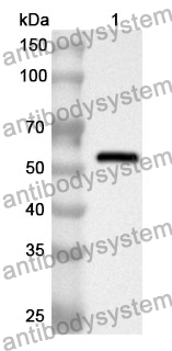 Anti-P4HB Polyclonal Antibody